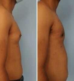 Amicus Clinic