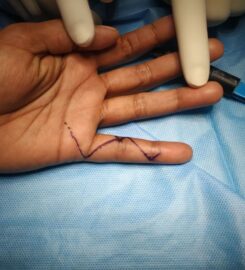 Amicus Clinic