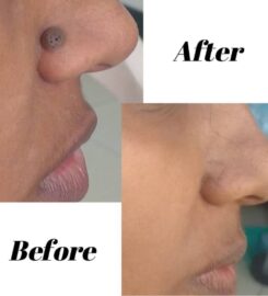 Amicus Clinic